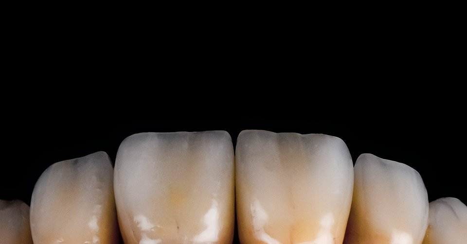 Ice Zirkon Translucent